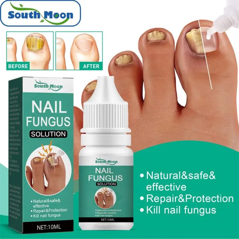 Nail Fungus Treatment Serum - Image 2