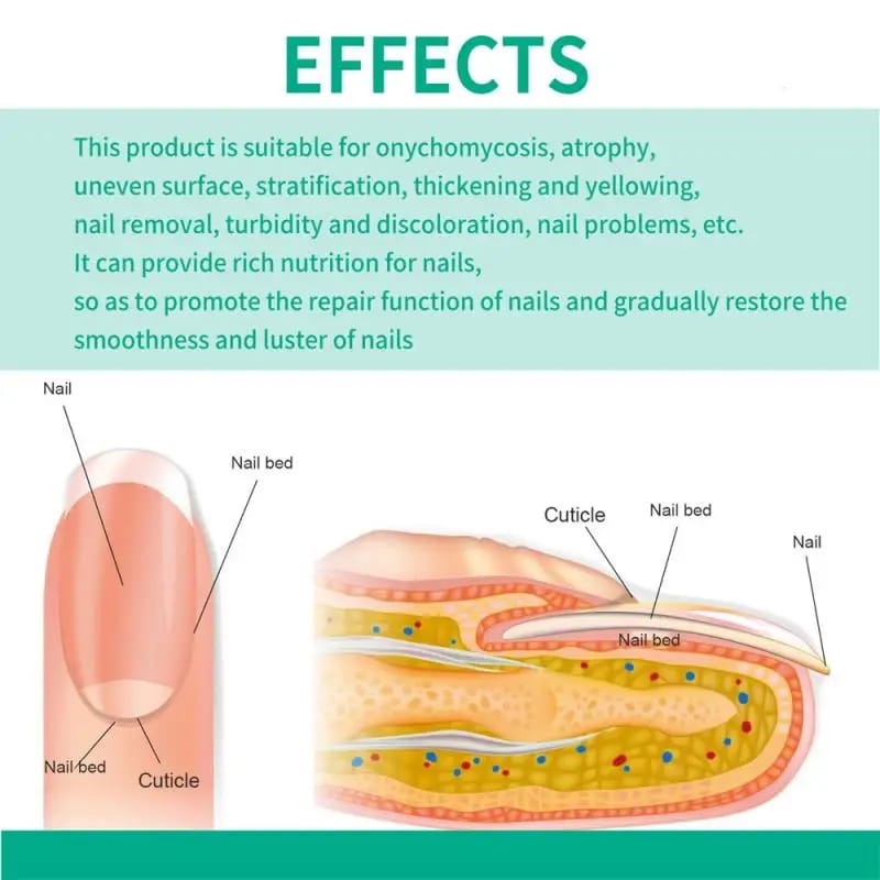 Nail Fungus Treatment Serum - Image 5