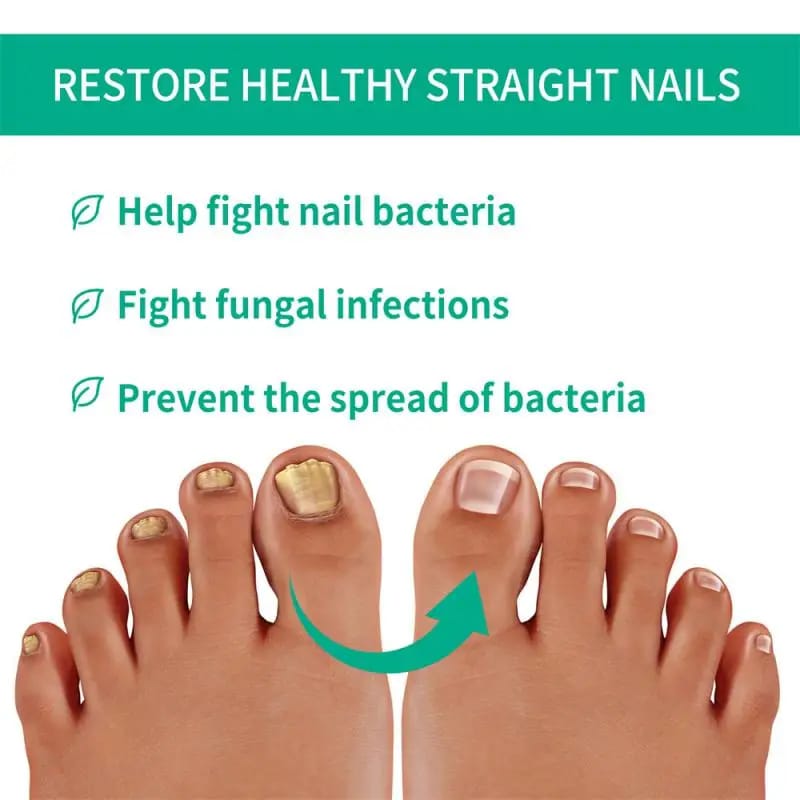 Nail Fungus Treatment Serum - Image 6